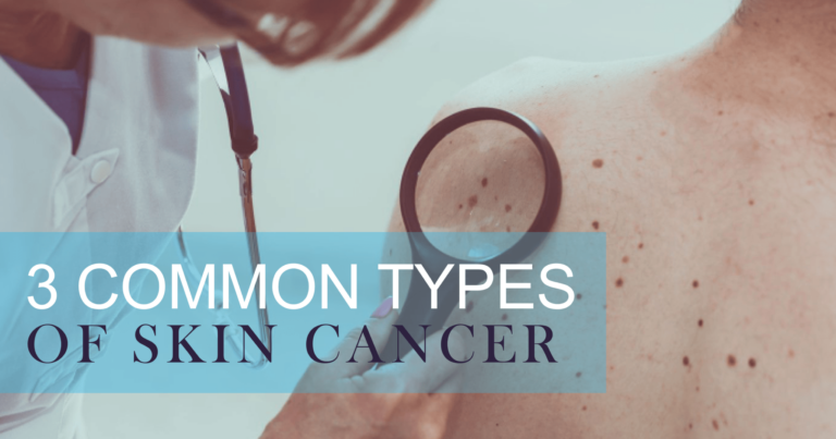 3 Common Types of Skin Cancer Image
