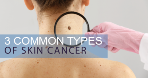 skin cancer common types