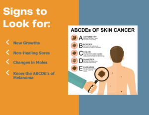 skin cancer signs
